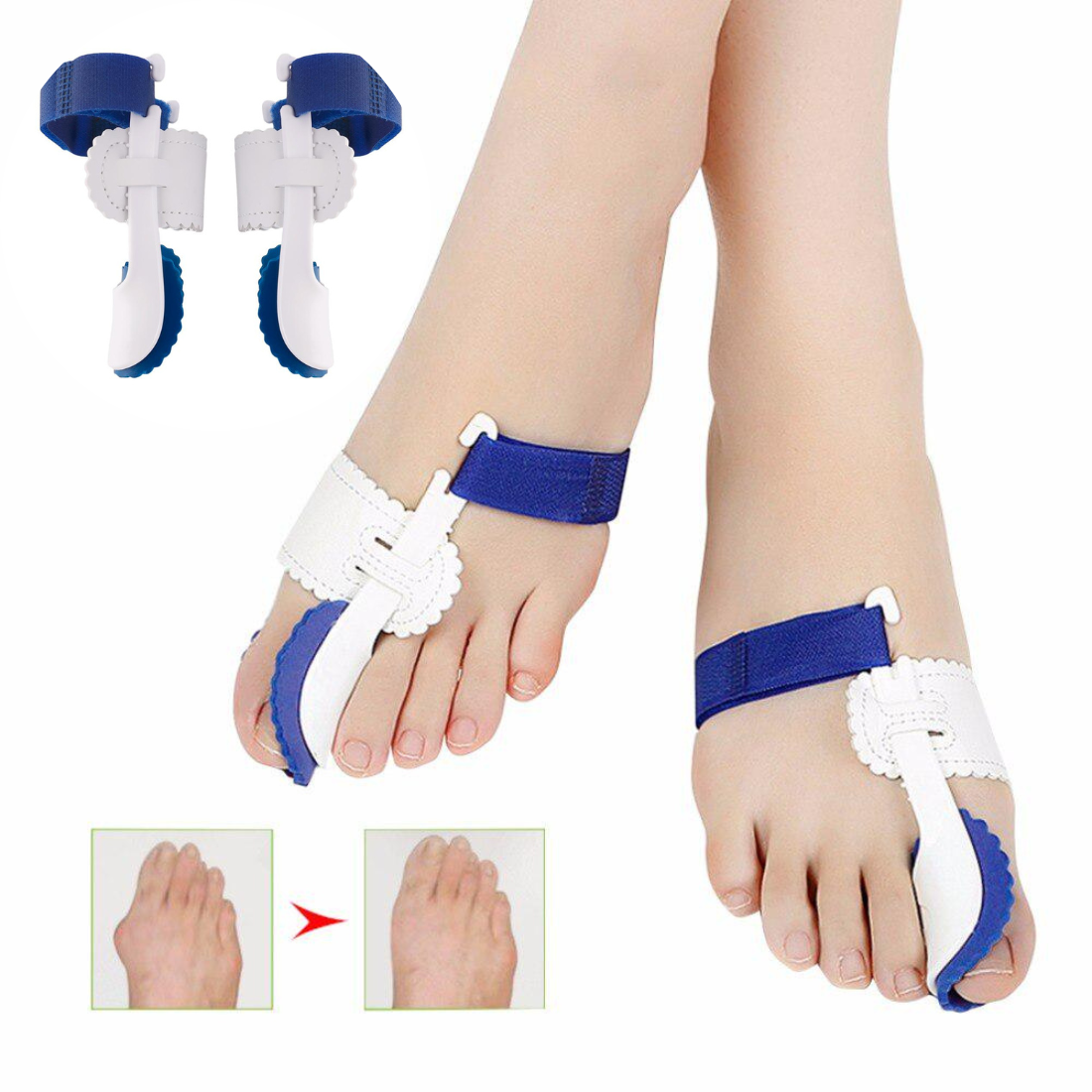 Īkšķa korektors, atdalītājs, 2 gabali