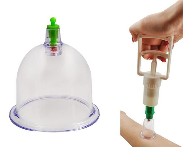 Ķīniešu vakuuma burbuļi piesūcekņi