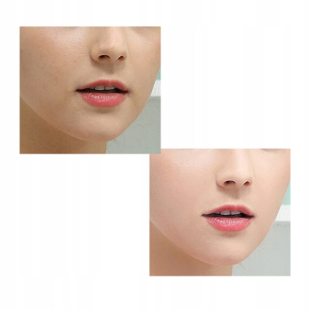 Ultraskaņas kavitācijas pīlinga aparāts zaļš