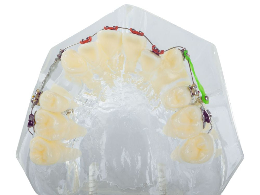 zobu, modelis, žoklis, teeth, zobu, bikšturi