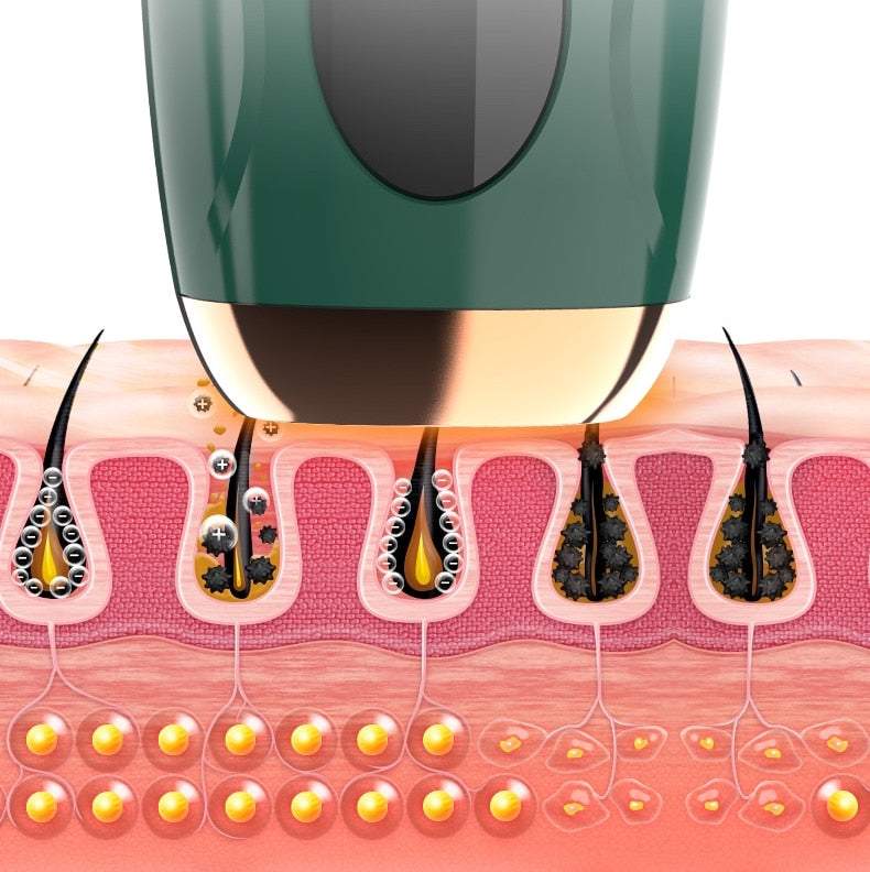 Fotoepilators ar IPL tehnoloģiju + saulesbrilles un skuveklis