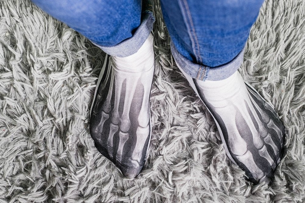 Smieklīga rentgena zeķe