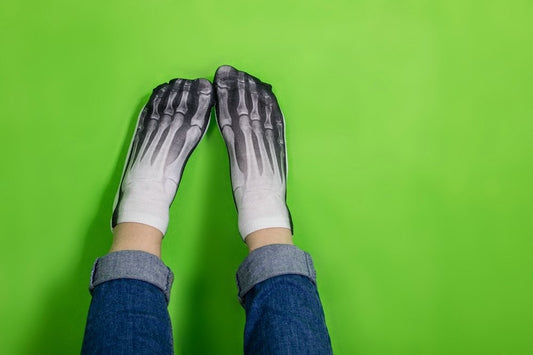 Smieklīga rentgena zeķe