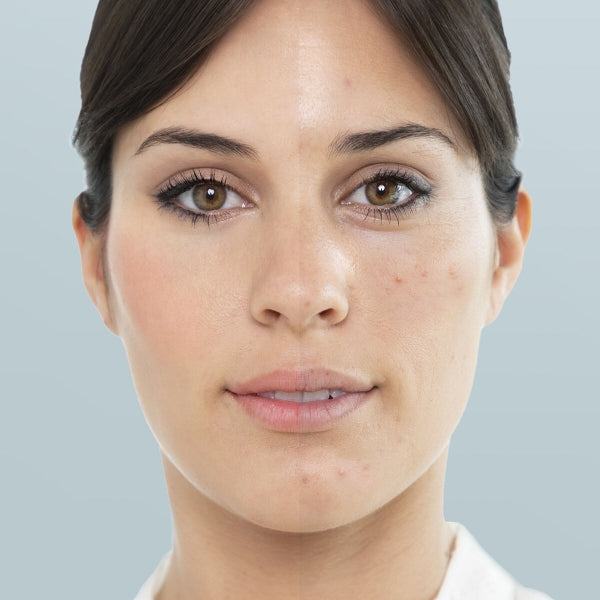 Elektriskā sejas sauna