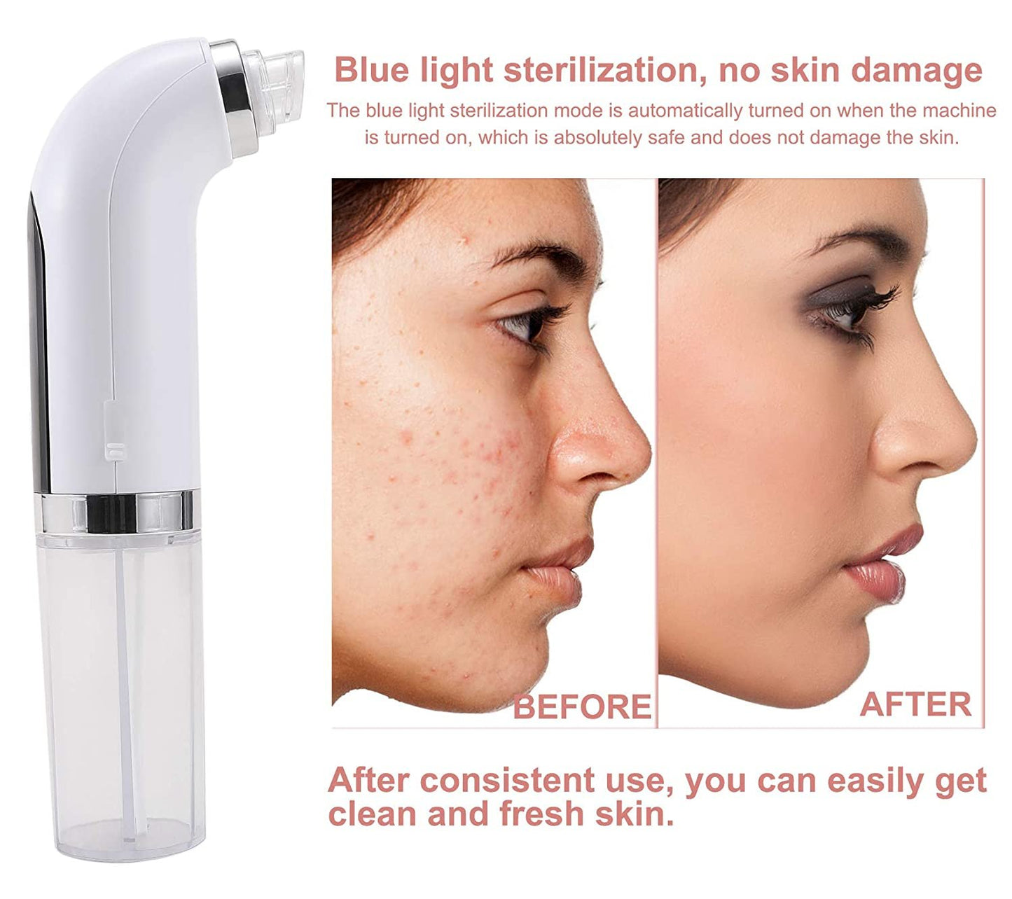 Sejas tīrītājs, poru sūknis ar ūdeni