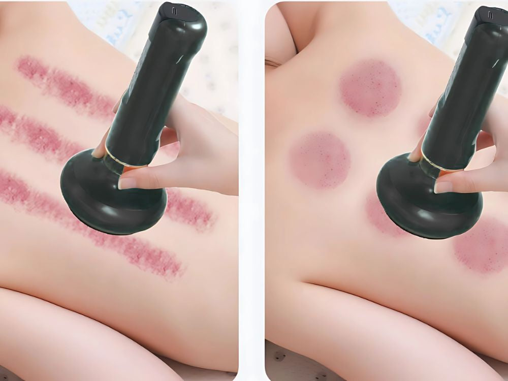 Ķīniešu burbuļu elektriskais vakuuma masieris ar 6 sūkšanas jaudas burbuļu eļļu