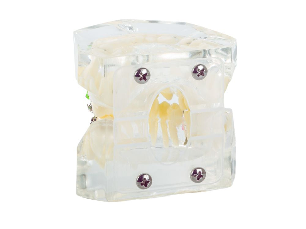 zobu, modelis, žoklis, teeth, zobu, bikšturi